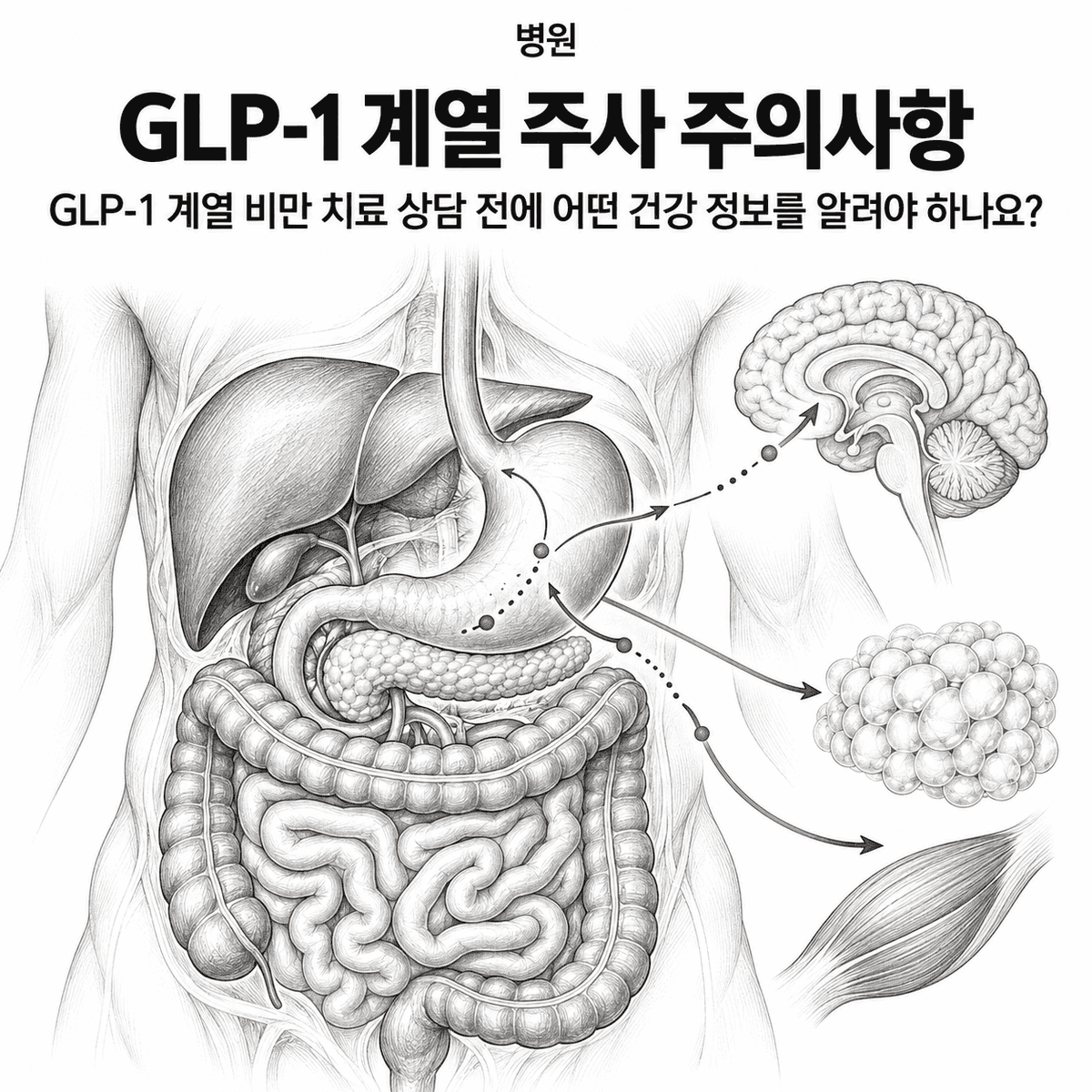 서울 병원 GLP-1 계열 주사 주의사항 핵심 정보 이미지